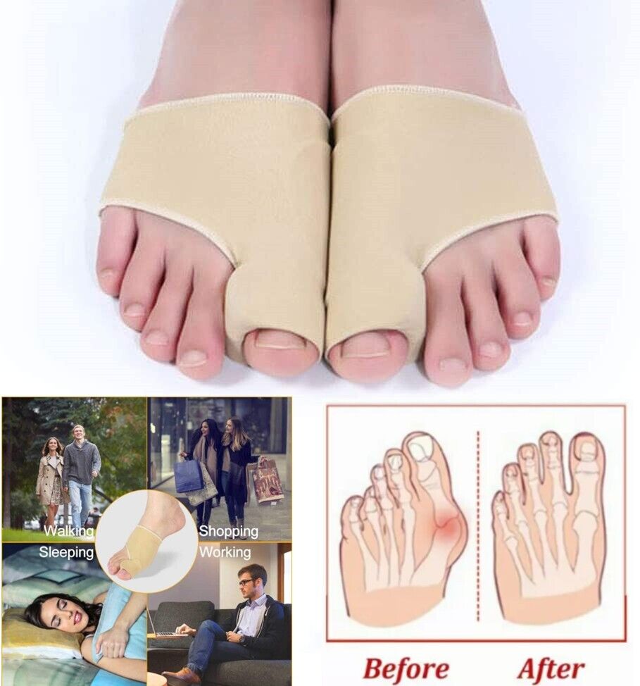 Toe Care Bunion Corrector Relieve Pain, Straighten Toes, & Boost Foot Health with Orthopedic Support & Stylish Look
