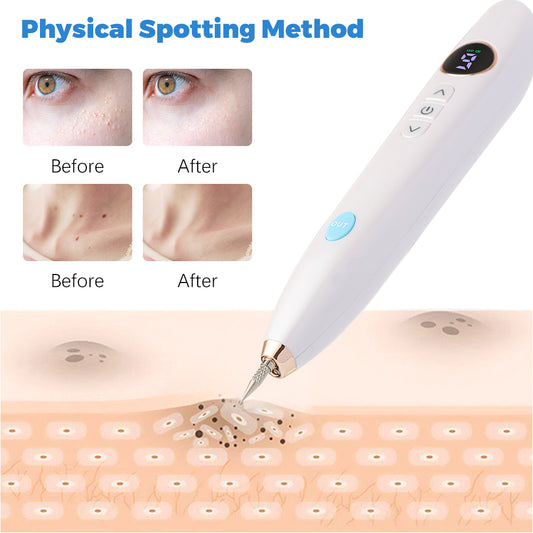 Laser Skin Tag & Mole Remover Plasma Pen for Face Freckle, Scar, Spot, Wart & Tattoo Removal